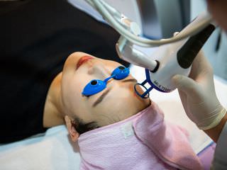 能收缩毛孔、祛痘的伤痕激光