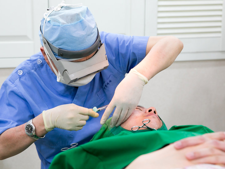 针对痘痕施针治疗