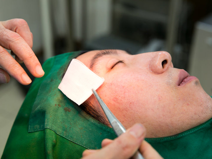 对治疗部位敷上医用纱布,治疗结束。