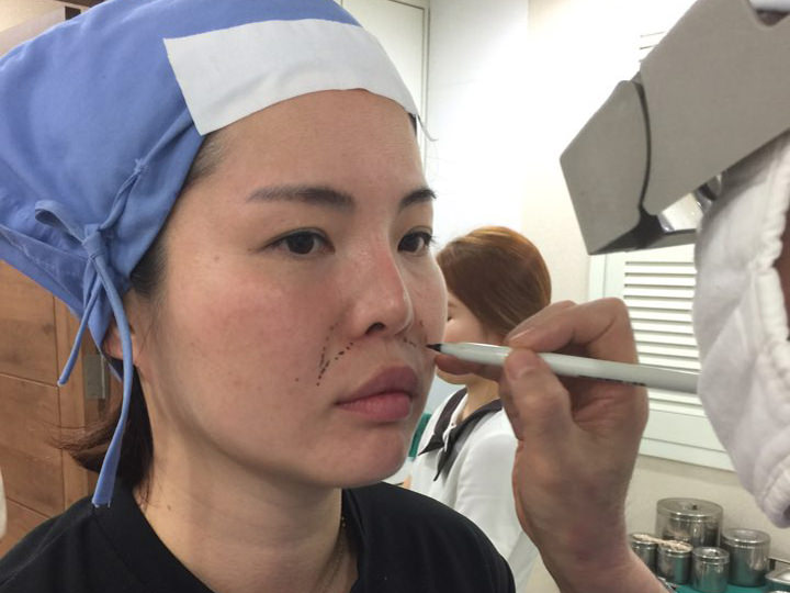 确认对施术部位