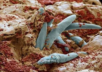 藏在皮肤里的螨虫