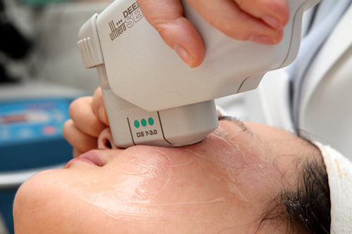 肤麻药、极致高弹镭射