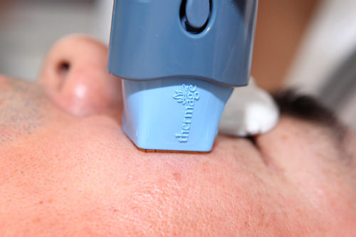 肤麻药、极致高弹镭射